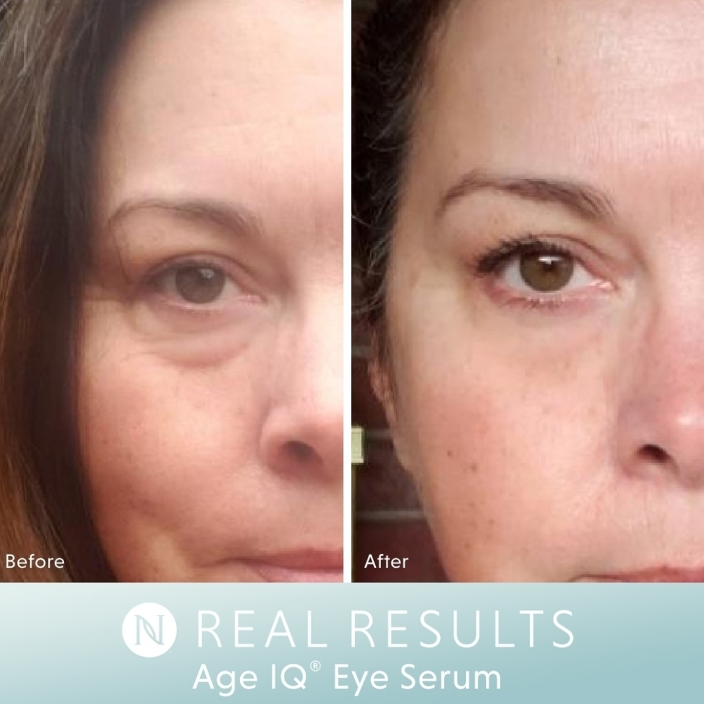 Eye Serum - Picture 6 of 8